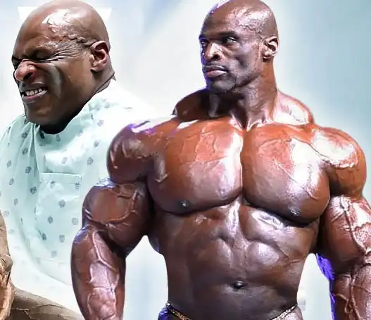 Ronnie Coleman’s struggles